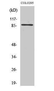 Western blot analysis of Jurkat cells using Anti-FKHRL1 Antibody