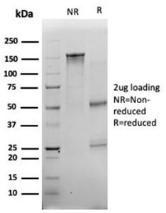 SDS-PAGE analysis of Anti-Myogenin Antibody [PCRP-MYOG-1C5] under non-reduced and reduced conditions; showing intact IgG and intact heavy and light chains, respectively. SDS-PAGE analysis confirms the integrity and purity of the antibody