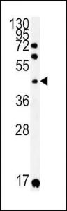 Anti-KIR2DS2 Rabbit Polyclonal Antibody (AP (Alkaline Phosphatase))