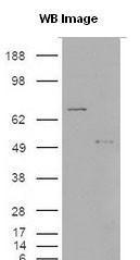 Anti-S100A9 Rabbit Polyclonal Antibody