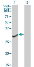 Anti-GTF2B Mouse Polyclonal Antibody