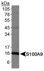 Anti-S100A9 Rabbit Polyclonal Antibody