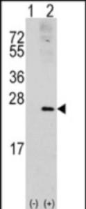 Anti-RAC1 Rabbit Polyclonal Antibody