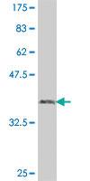 Anti-UBE2J1 Mouse Polyclonal Antibody