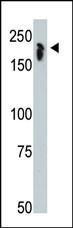 Anti-NCOR1 Rabbit Polyclonal Antibody