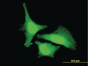 Anti-ZAK Mouse Monoclonal Antibody [clone: 3B6]