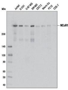 Anti-NCOR1 Rabbit Polyclonal Antibody