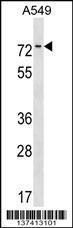 Anti-HKR1 Rabbit Polyclonal Antibody