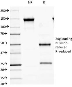 SDS-PAGE analysis of Anti-MALT1 Antibody [MT1/410] under non-reduced and reduced conditions; showing intact IgG and intact heavy and light chains, respectively. SDS-PAGE analysis confirms the integrity and purity of the antibody.