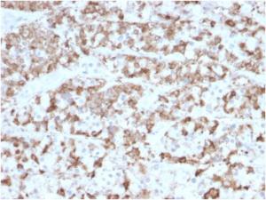 Immunohistochemical analysis of formalin-fixed, paraffin-embedded human pituitary using Anti-Prolactin Antibody [PRL/2910]