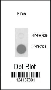 Anti-PLB1 Rabbit Polyclonal Antibody