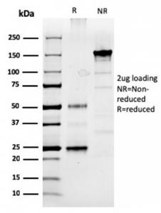 SDS-PAGE analysis of Anti-Prolactin Antibody [PRL/2910] under non-reduced and reduced conditions; showing intact IgG and intact heavy and light chains, respectively. SDS-PAGE analysis confirms the integrity and purity of the antibody