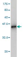 Anti-BUB1B Mouse Monoclonal Antibody [clone: 3F2]