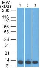 Anti-S100A8/A9 Rat Monoclonal Antibody [clone: 63N13G5]