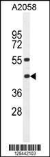 Anti-HLA-B Rabbit Polyclonal Antibody (AP (Alkaline Phosphatase))