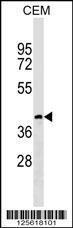 Anti-CC113 Rabbit Polyclonal Antibody (FITC (Fluorescein Isothiocyanate))