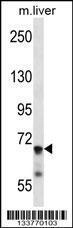 Anti-IL1R1 Rabbit Polyclonal Antibody (AP (Alkaline Phosphatase))