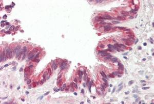 Anti-BIRC6 Antibody (A83896) (3.75 µg/ml) staining of paraffin embedded Human Lung. Steamed antigen retrieval with citrate buffer pH 6, AP-staining