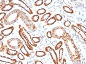 Immunohistochemical analysis of formalin-fixed, paraffin-embedded human renal cell carcinoma using Anti-CD137 Antibody [4-1BB/3201]