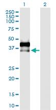 Anti-AREG Rabbit Polyclonal Antibody