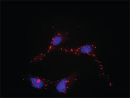 Anti-RAF1 Antibody Pair