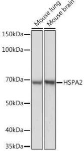 Western blot analysis of extracts of various cell lines, using Anti-HSPA2 Antibody [ARC1415] (A9952) at 1:1,000 dilution