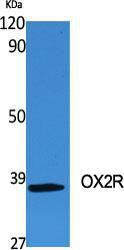 Western blot analysis of various cells using Anti-MOX2R Antibody