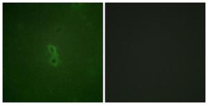 Immunofluorescence analysis of NIH/3T3 cells using Anti-BCL-XL (phospho Thr47) Antibody. The right hand panel represents a negative control, where the antibody was pre-incubated with the immunising peptide