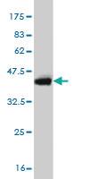 Anti-UBE2J1 Mouse Monoclonal Antibody [clone: 6A12]