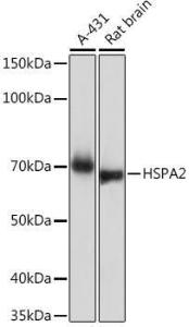 Western blot analysis of extracts of various cell lines, using Anti-HSPA2 Antibody [ARC1415] (A9952) at 1:1,000 dilution