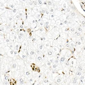 Immunohistochemistry analysis of paraffin-embedded human liver using Anti-Gelsolin Antibody (A305452) at a dilution of 1:50 (40x lens). Perform high pressure antigen retrieval with 10 mM citrate buffer pH 6.0 before commencing with IHC staining protocol.