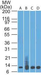 Anti-S100A8/A9 Mouse Monoclonal Antibody [clone: 48M7C7]