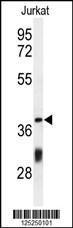 Anti-CC130 Rabbit Polyclonal Antibody (APC (Allophycocyanin))