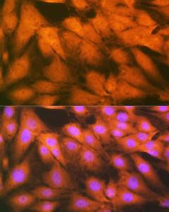 Immunofluorescence analysis of C6 cells using Anti-HSPA2 Antibody [ARC1415] (A9952) at a dilution of 1:100 (40X lens). DAPI was used to stain the cell nuclei (blue)