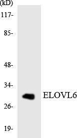 Western blot analysis of the lysates from K562 cells using Anti-ELOVL6 Antibody