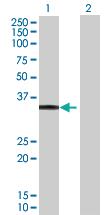 Anti-MYOZ2 Mouse Polyclonal Antibody