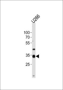 Anti-NKX3-2 Rabbit Polyclonal Antibody (AP (Alkaline Phosphatase))