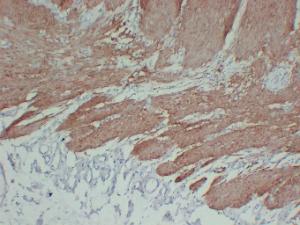 Immunohistochemical analysis of paraffin-embedded human Colon using Anti-Calponin 1 Antibody