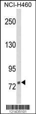 Anti-DGCR8 Rabbit Polyclonal Antibody (AP (Alkaline Phosphatase))