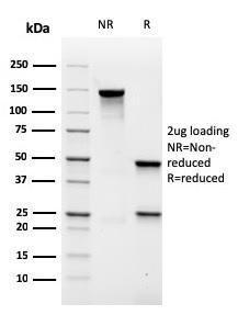 SDS-PAGE analysis of Anti-MALT1 Antibody [rMT1/410] under non-reduced and reduced conditions; showing intact IgG and intact heavy and light chains, respectively SDS-PAGE analysis confirms the integrity and purity of the antibody