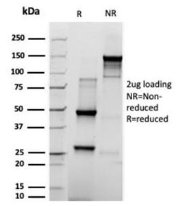 SDS-PAGE analysis of Anti-Prolactin Antibody [rPRL/4909] under non-reduced and reduced conditions; showing intact IgG and intact heavy and light chains, respectively. SDS-PAGE analysis confirms the integrity and purity of the antibody