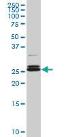 Anti-PAFAH1B3 Mouse Monoclonal Antibody [clone: 3G6]