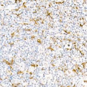 Immunohistochemistry analysis of paraffin-embedded human tonsil using Anti-Gelsolin Antibody (A305452) at a dilution of 1:50 (40x lens). Perform high pressure antigen retrieval with 10 mM citrate buffer pH 6.0 before commencing with IHC staining protocol.