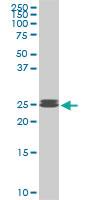 Anti-PAFAH1B3 Mouse Monoclonal Antibody [clone: 3G6]