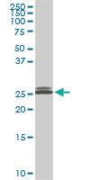 Anti-PAFAH1B3 Mouse Monoclonal Antibody [clone: 3G6]