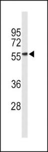 Anti-KIR3DL2 Rabbit Polyclonal Antibody (FITC (Fluorescein Isothiocyanate))