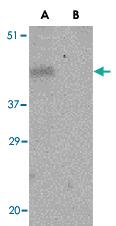 Anti-PD1 Rabbit Polyclonal Antibody