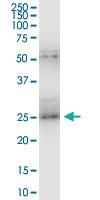 Anti-TK1 Polyclonal Antibody Pair