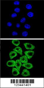 Anti-CITED2 Rabbit Polyclonal Antibody (PE (Phycoerythrin))