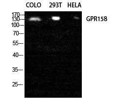 Anti-GPR158 Rabbit Polyclonal Antibody